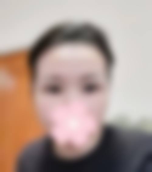 三、张建华医生擅长项目介绍