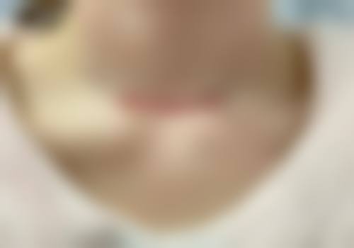7、上海璟华整形医院价格表/收费区间参考