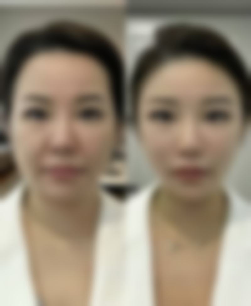 五、香港恒時整形医院收费价格表/收费标准
