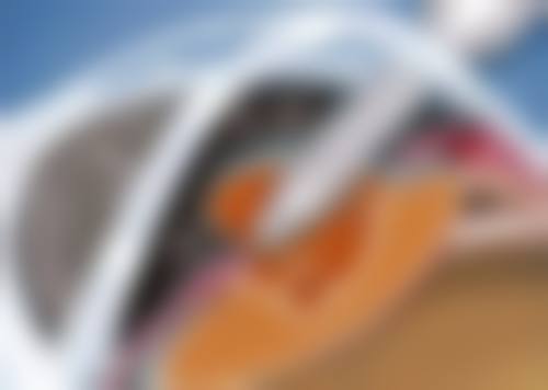八、患者常见问题解答（精选 ）
