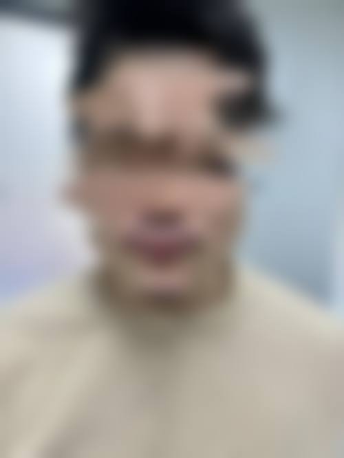 十三、杭州雍禾发之初植发医院患者常见问答