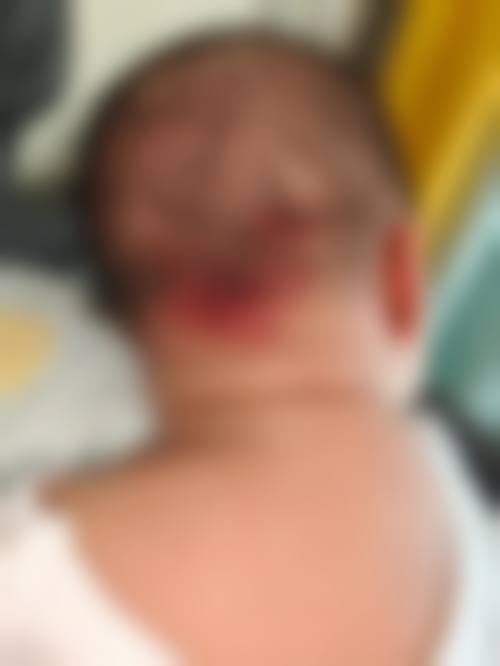 西安赫比医疗美容门诊部鼻部整形技术优势