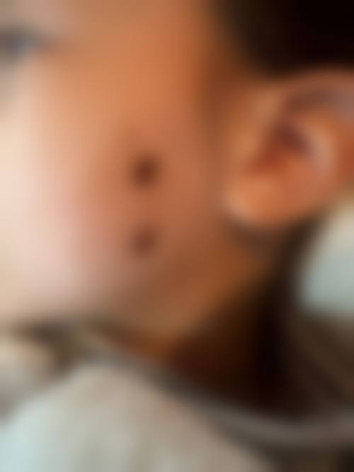 聊城时之钥整形医院价格表