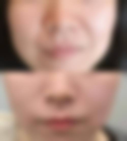 二、长沙爱思特卓而美整形医疗美容门诊部正规可靠吗?