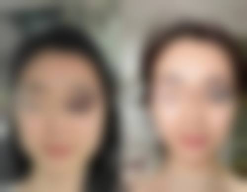 五、长沙爱思特卓而美整形医疗美容门诊部特色技术及优质服务