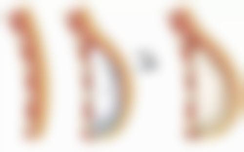 韓國今日安MINISH牙科醫院怎麼預約掛號？2026預約流程+方法！香港人必睇攻略
