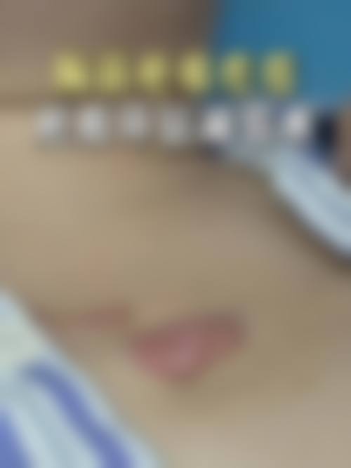 五、贵州奇迹美整形医院真实实例参考