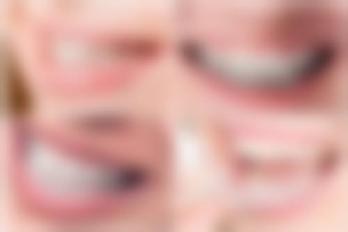 深圳正恩吉呈口腔门诊部设备仪器清单