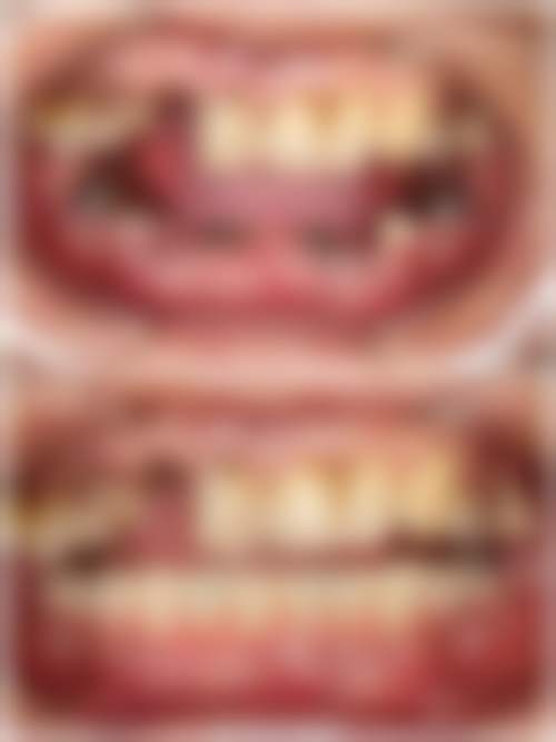 一、深圳正恩向西口腔门诊部怎么样?是全品类口腔医疗服务专科医院