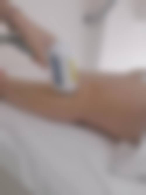 十、相关科普内容推荐:强脉冲光子嫩肤