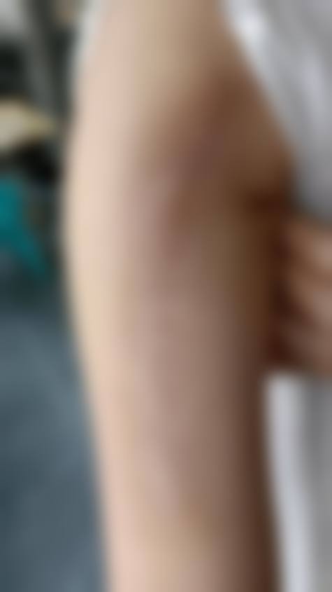 九、深圳京韩兰茂梵美医疗整形美容门诊部患者常见问题解答(精选 )