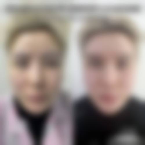 五、广州艺星韩后医疗美容医院真实实例参考