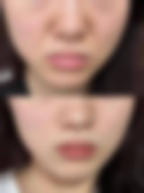 十、患者常见问题解答（精选 ）
