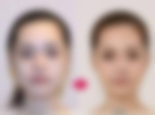 1、主要做的三大诊疗项目