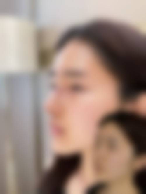 拓展延伸:男生鼻整形必知3件事