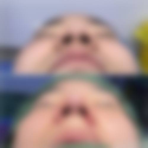理性提醒