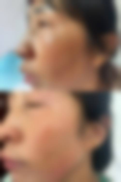 西安市中医医院皮肤科正规资质及靠谱实力