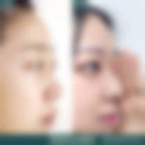 优惠活动与价格参考