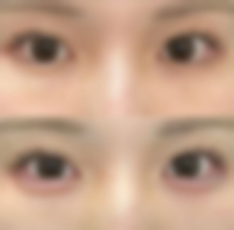 韓國VSline醫院怎麼預約掛號 避坑指南:呢啲陷阱千祈唔好踩!