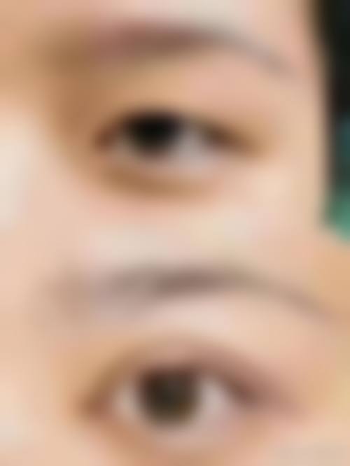 深圳刘运奇医疗美容门诊部患者常见问题解答(精选 )