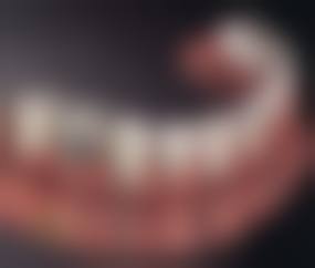 擅长项目详解