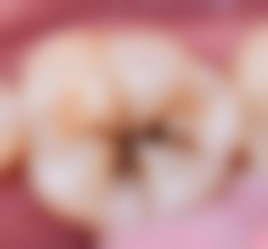优惠活动详情:限时特别优惠不容错过