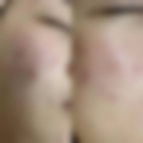 深圳刘运奇医疗美容门诊部特色技术优势及特色技术服务