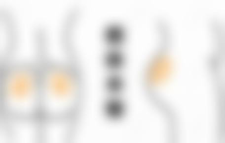 三、兰斯吸脂吸背部与其他方式对比,优势在哪