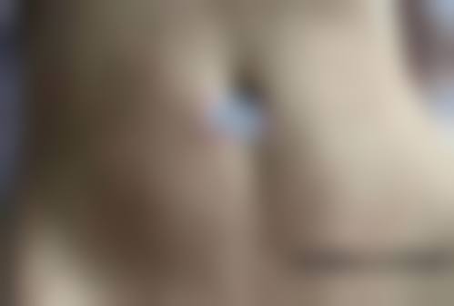 五、徐州医 科汇美整形美容医院真实实例参考