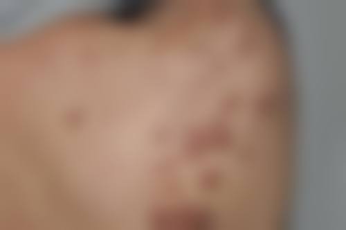 九、杭州艺星城北医疗美容诊所口碑与评价