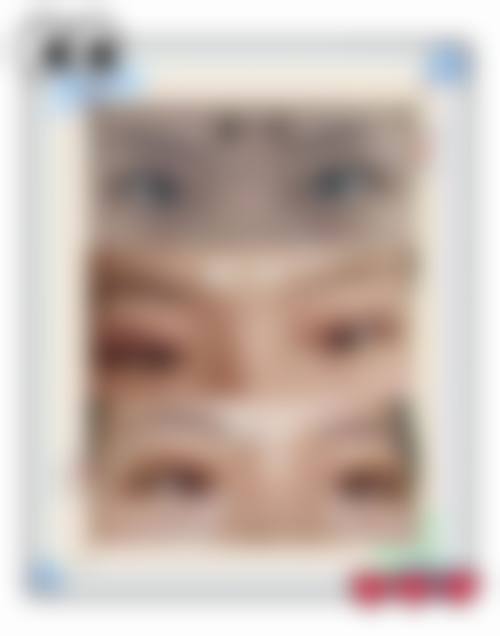 杭州艺星余杭医疗美容诊所患者常见问题解答（精选）