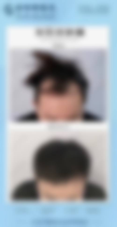 Honesty整形外科医院价格表/收费标准一览