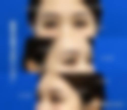 杭州艺星余杭医疗美容诊所特色诊疗项目