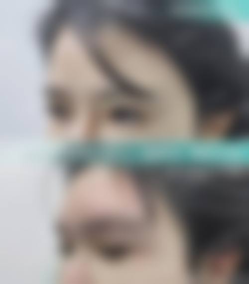 杭州艺星余杭医疗美容诊所价格表/收费标准一览