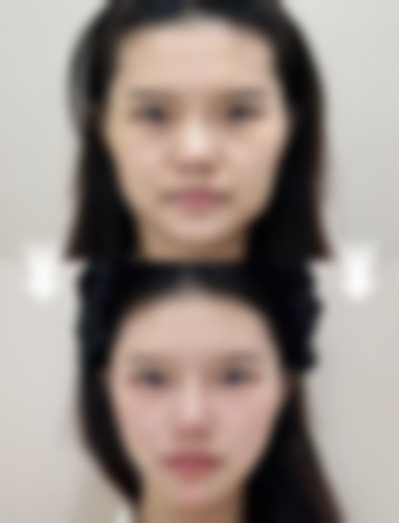 特色科室与项目:500种项目覆盖全脸,个性化定制方案