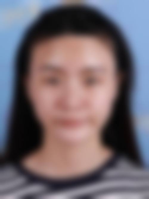 实例2:28岁女性阴唇整形术