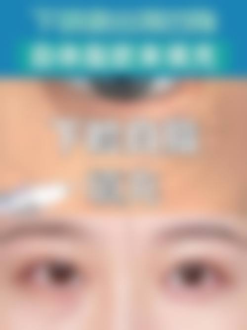 常见认可点