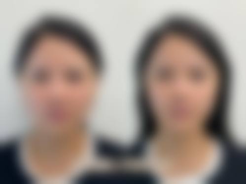 3. 面部与形体美容
