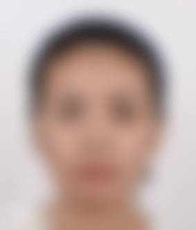 2. 微创技术革新