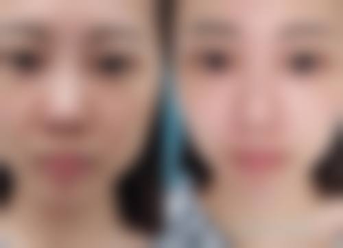 1. 个性化治疗方案设计