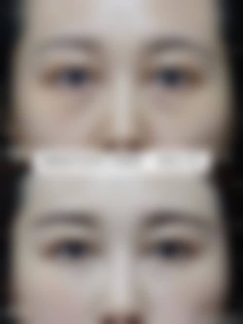 十、相关科普内容推荐:阴道紧缩术