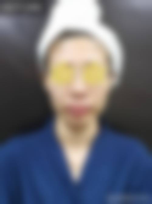 风险与术后修复
