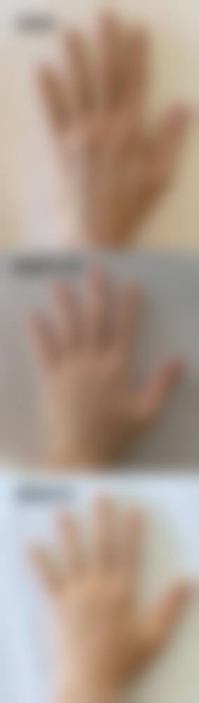 1. 女性私密整形