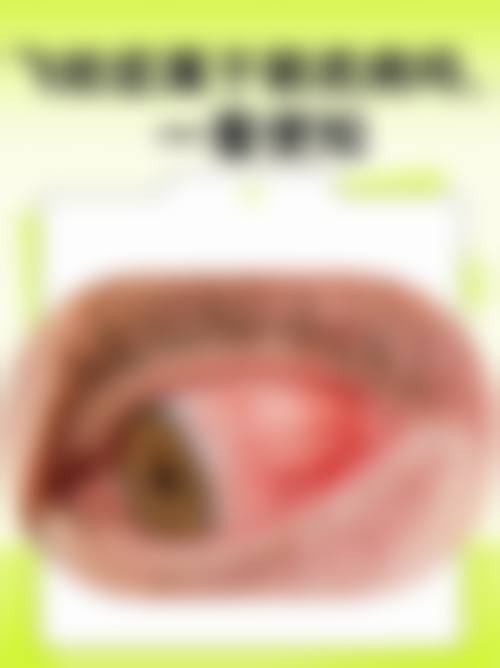 预约优惠活动