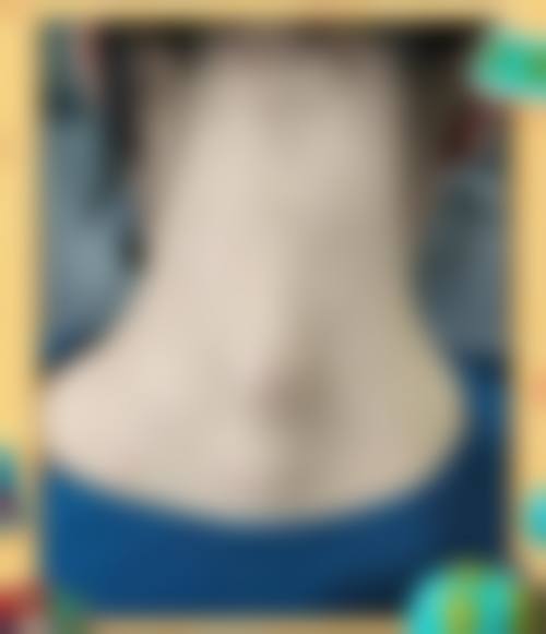 结语:选择正规医美,从预约开始