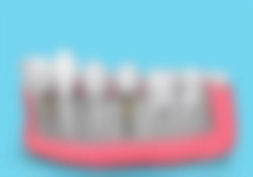 香港vs珠海種牙價錢+多次對比:慳幾多?值唔值過大海?