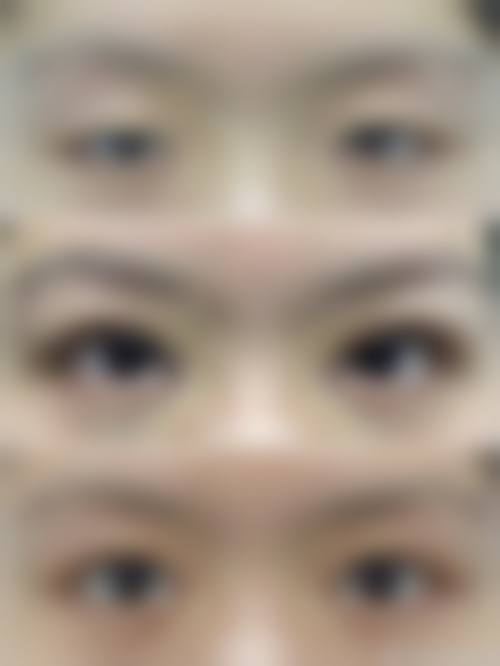 特色科室与项目——眼鼻整形,审美自然