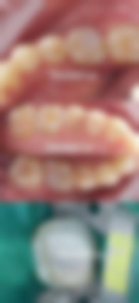 结尾:选择武汉优益佳口腔,开启自信笑容