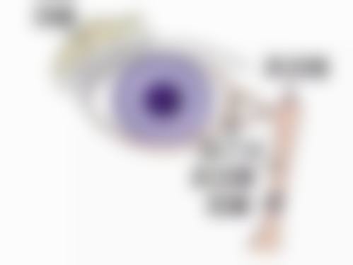 优惠活动详情:全飞秒原价25000元,优惠价18000元