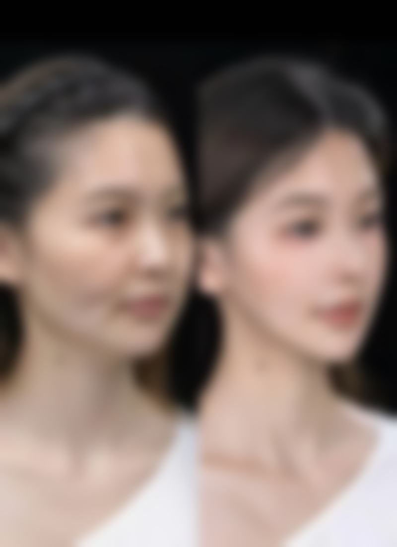 四、魏艳玲医生做手术价格